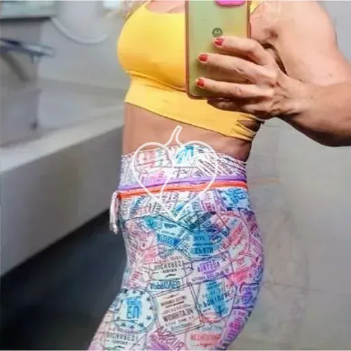 Anny Lima